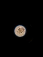 Pinworm.jpg Pinworm.jpg