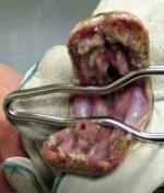 stomatitis.jpg stomatitis.jpg