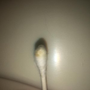 the Q-tip I used to gently move the stuck shed on the bottom of his tail (stained?)