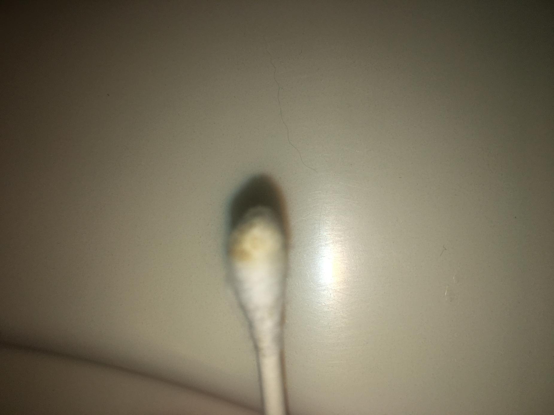 the Q-tip I used to gently move the stuck shed on the bottom of his tail (stained?)